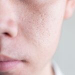 چگونه منافذ پوست را قبل از آرایش ببندیم؟